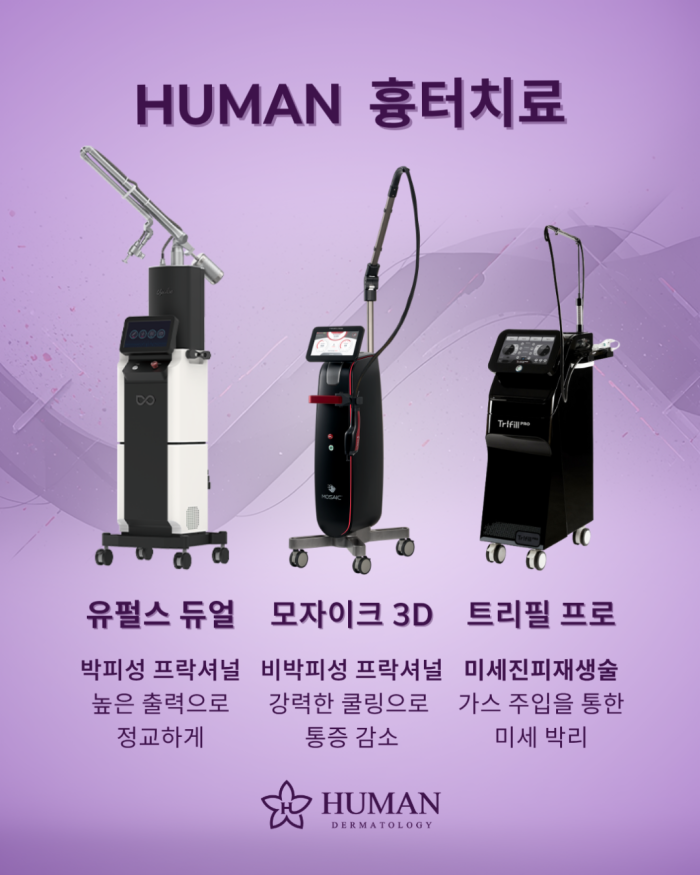 시술정보